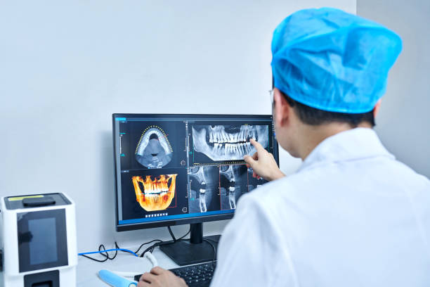 Best Emergency Wisdom Tooth Extraction in Jessup, PA